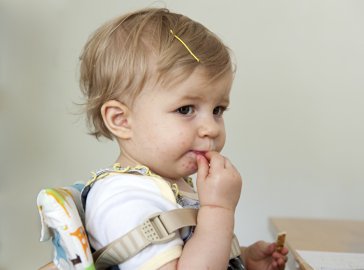 Foto von Kleinkind mit Ausschlag am Mund